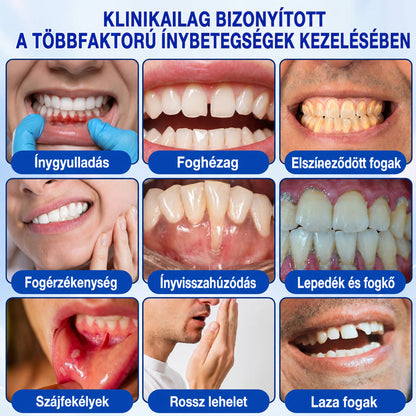 🇭🇺🍄🦷1️⃣ Trilumia® GumRevive – fejlett gél az íny és a fogágy ápolására